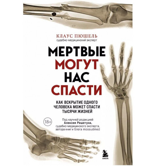Клаус Пюшель: Мертвые могут нас спасти. Как вскрытие одного человека может спасти тысячи жизней-1